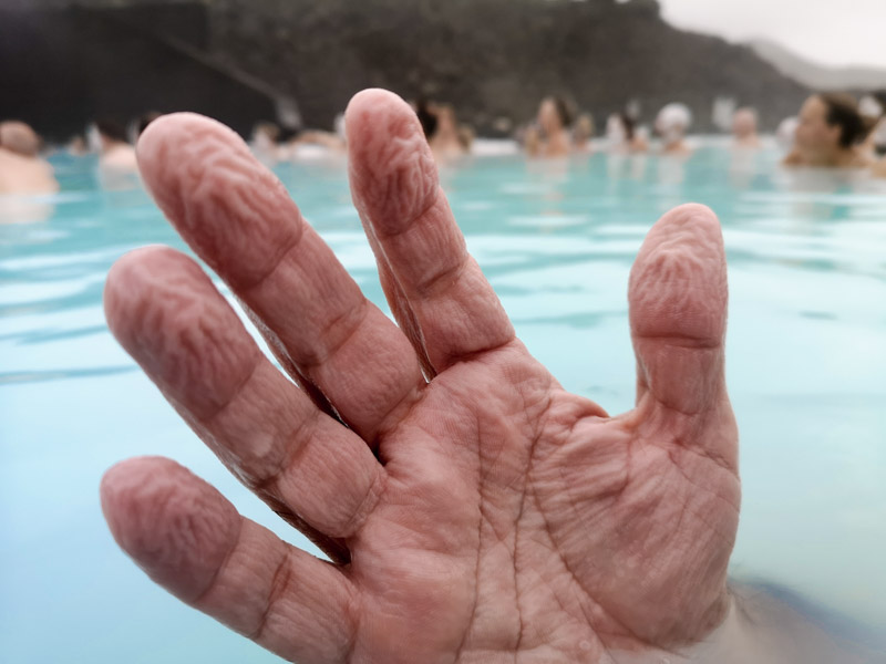 la mano di Mauro dopo il bagno di qualche ora è diventata rugosa